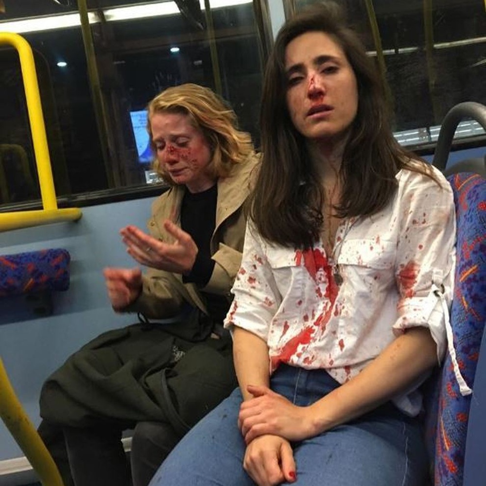 GB, lesbiche rifiutano di baciarsi sul bus, picchiate da omofobi