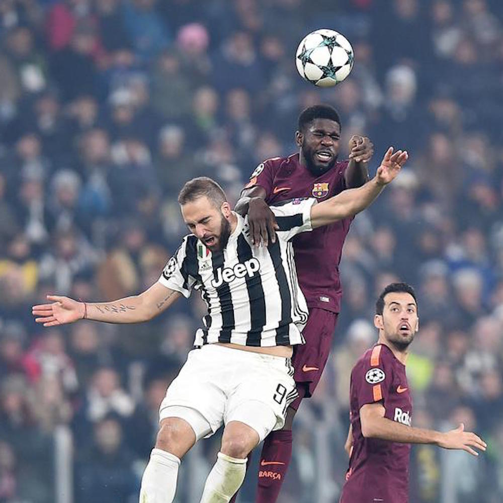 Juventus, Higuain salta il Napoli: si dovrà operare alla mano