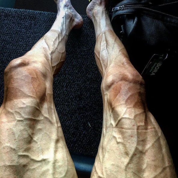 L’incredibile foto delle gambe del ciclista dopo 16 tappe di Tour de France