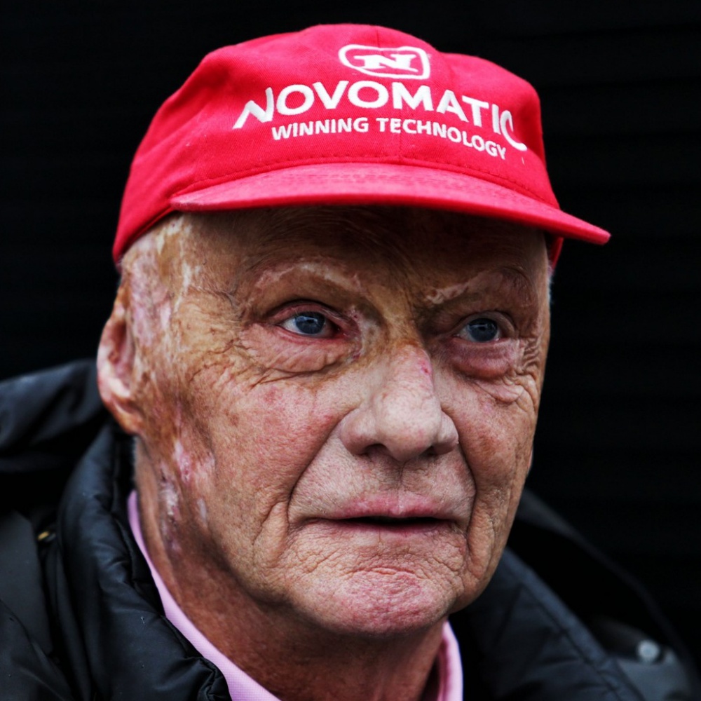 Niki Lauda ora sta meglio, dimesso dall'ospedale di Vienna
