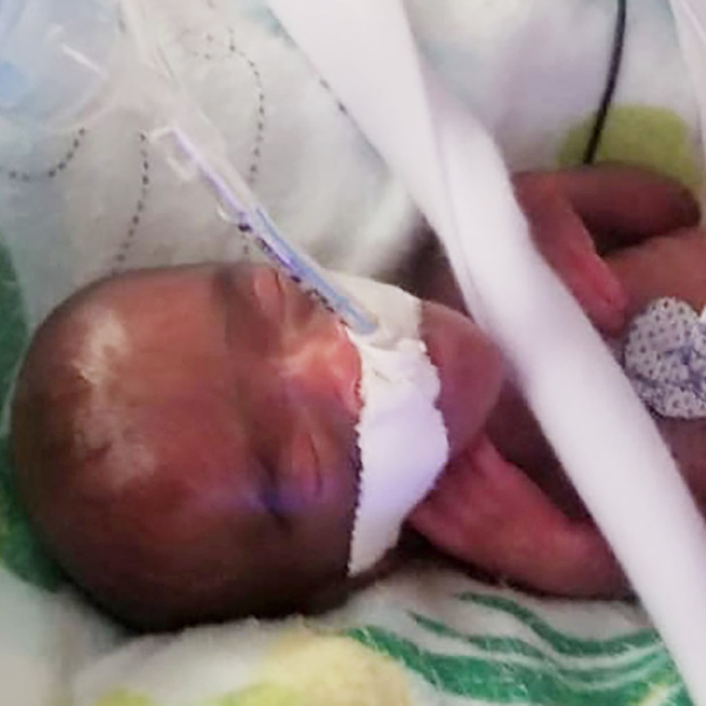 Usa, sopravvissuta la neonata più piccola del mondo