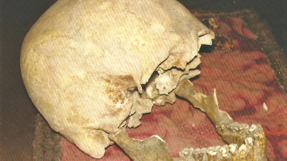 Cranio misterioso potrebbe essere di Plinio il Vecchio