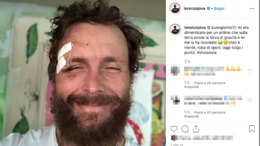 Jovanotti si fa male al viso e posta foto su Instagram, niente di grave