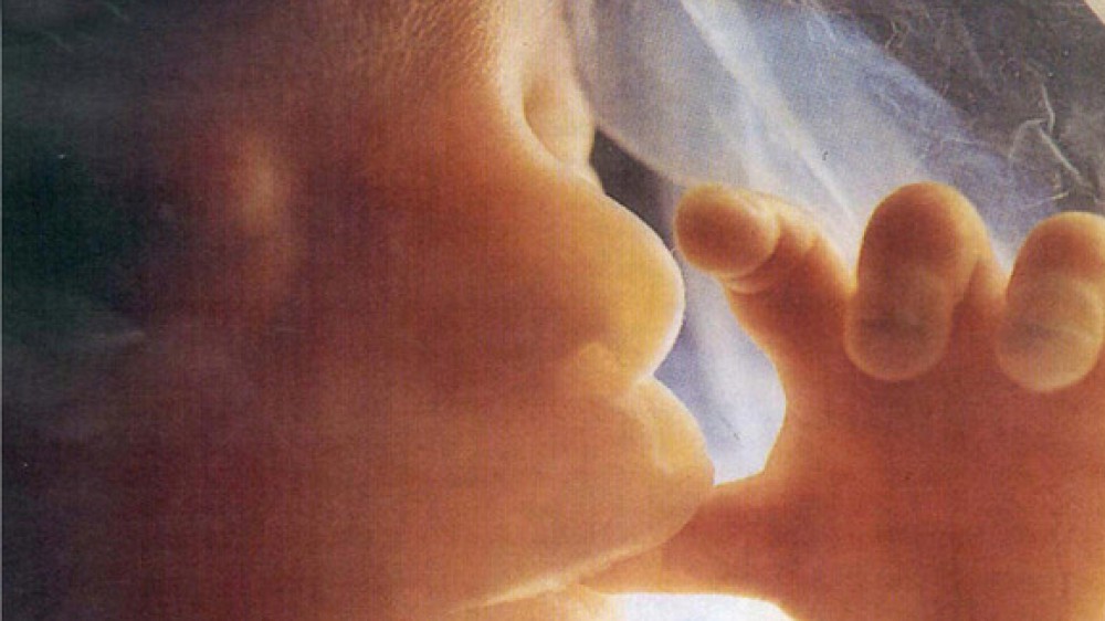 Le microplastiche arrivano all'uomo prima di nascere; una ricerca italiana ne svela la presenza nella placenta