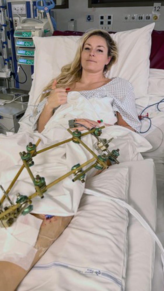 Linsday Vonn è tornata negli Stati Uniti