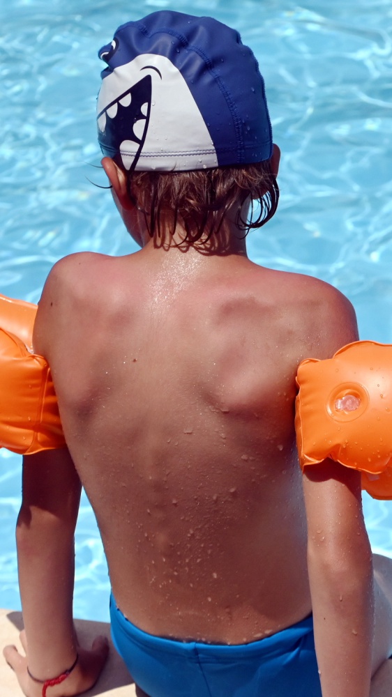 Rende: un altro bimbo annegato in piscina a poca distanza dall'episodio dell'acquapark di Brescia