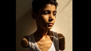 La guerra di Gaza, le vittime più indifese: la Foto dell'Anno 2025 ritrae un bambino palestinese senza braccia