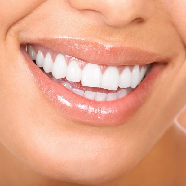 Allarme dentisti, otturazioni argento sono pericolose