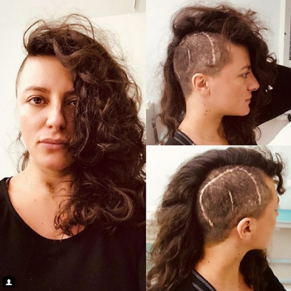 Clio Evans, sui social una foto mostra le cicatrici in testa