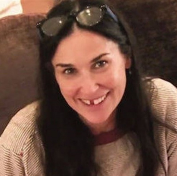 Demi Moore racconta: "Ho perso i denti a causa dello stress"