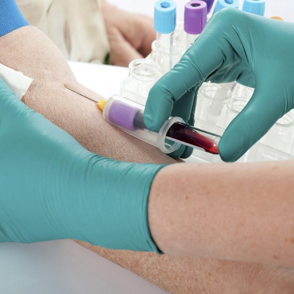 Depressione, in futuro si diagnosticherà con un esame del sangue