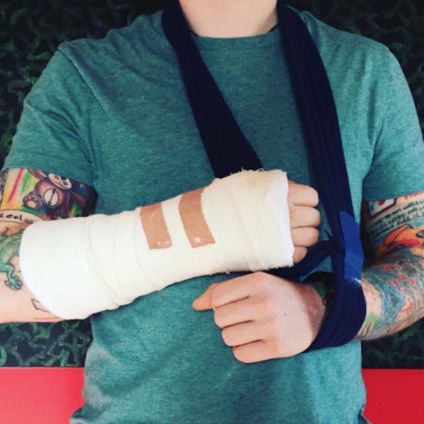 Ed Sheeran, piccolo incidente in bici: tour a rischio
