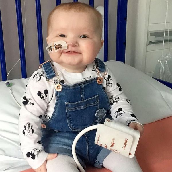 Gb, si cerca donatore per Phoebe, ha 1 anno e la leucemia