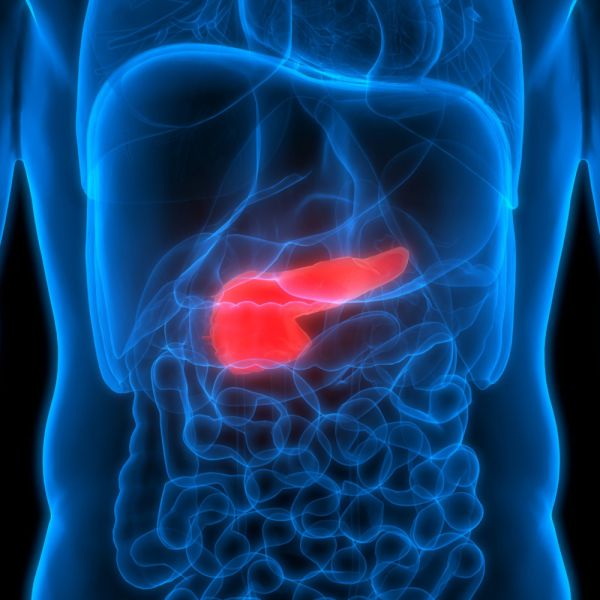 Intelligenza artificiale per la cura del cancro al pancreas