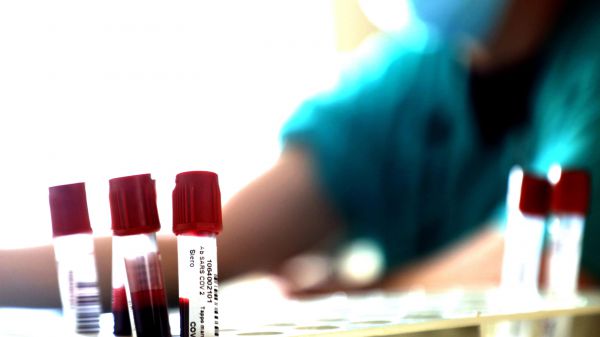 Coronavirus, ecco i super anticorpi contro la pandemia