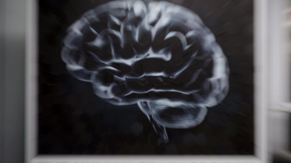 Nasce con metà cervello ma ha un'intelligenza sopra la media