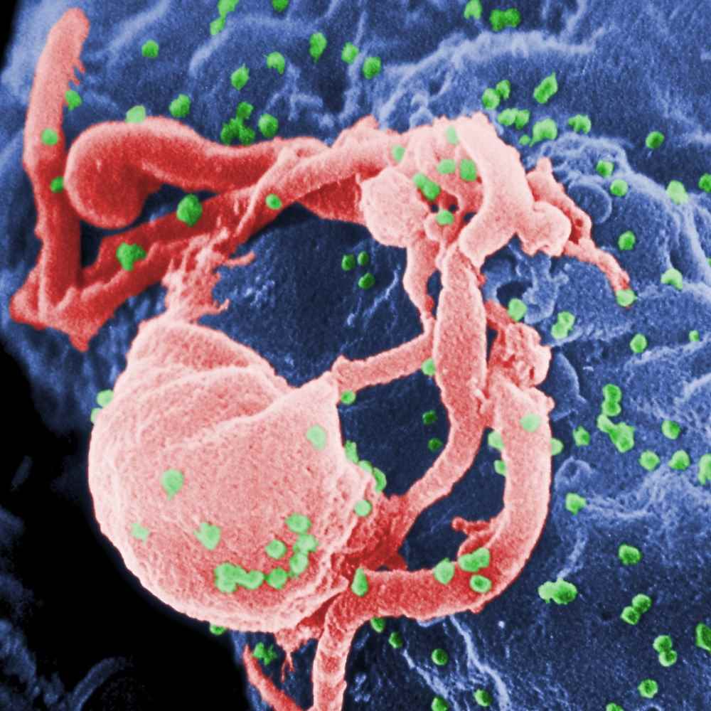Lotta Aids, eliminato Hiv nel secondo paziente al mondo
