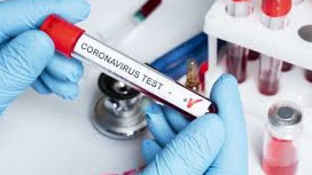 Identificata in un paziente di Palermo, già vaccinato, la variante brasiliana del Covid, l'uomo, di 83 anni, è immunodepresso