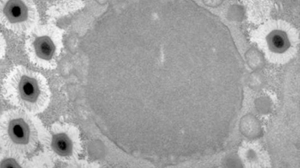 Si chiama Thiomargarita magnifica, è un batterio da 1 centimetro, scoperto nell’arcipelago di Guadalupa