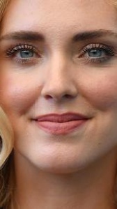 Chiara Ferragni parla della sua acne: “La mia più grande insicurezza fisica è stata la mia pelle”