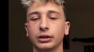 Milano violenta, l'influencer George Ciupilan aggredito. Video choc